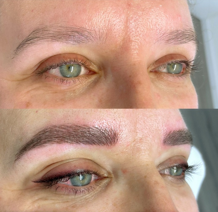 Sanftes Lidstrich-Shading vor und nach der Behandlung